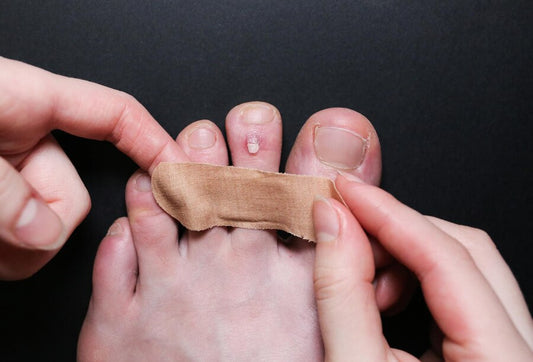 Home Remedies for Foot Infection