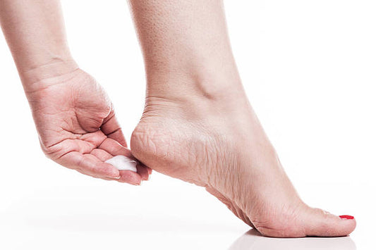 Natural Ways to Heal Foot Cracks in Winter