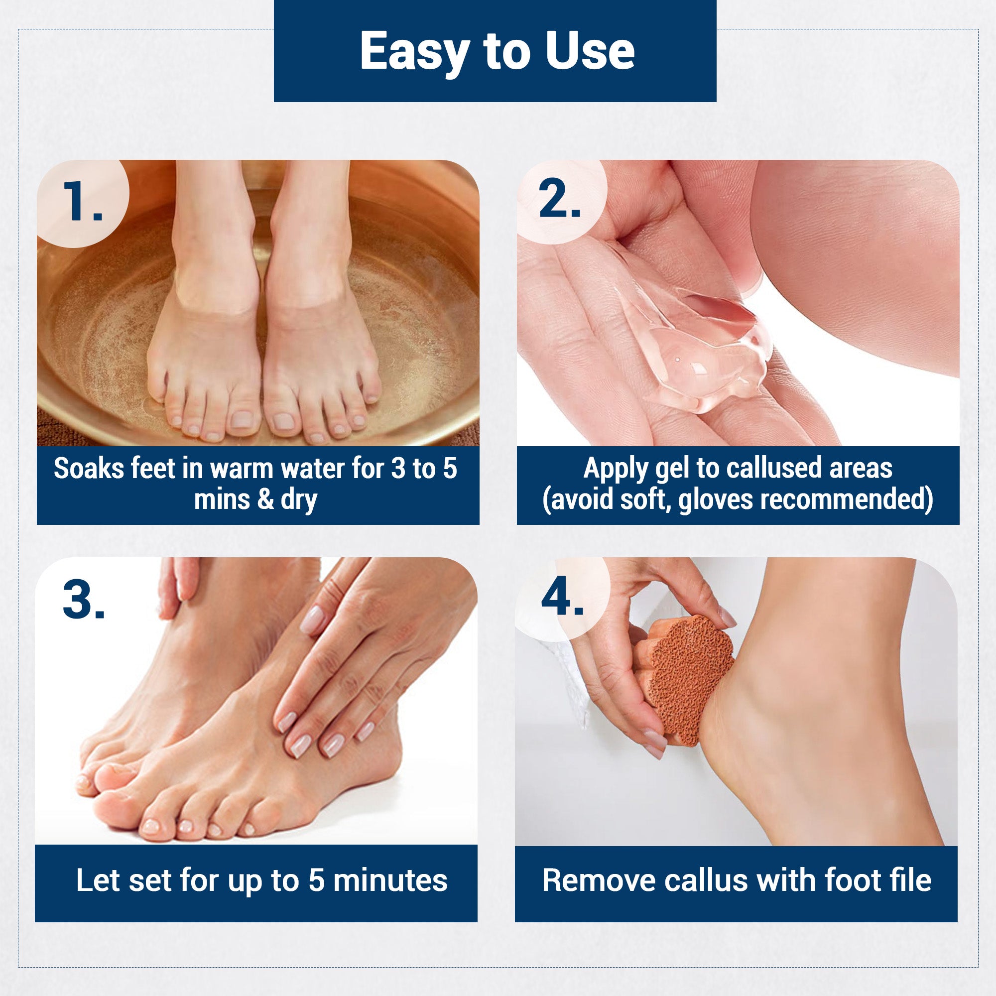 Dry Cracked Feet Callus On Heel Hurts Callus Removal Calloused