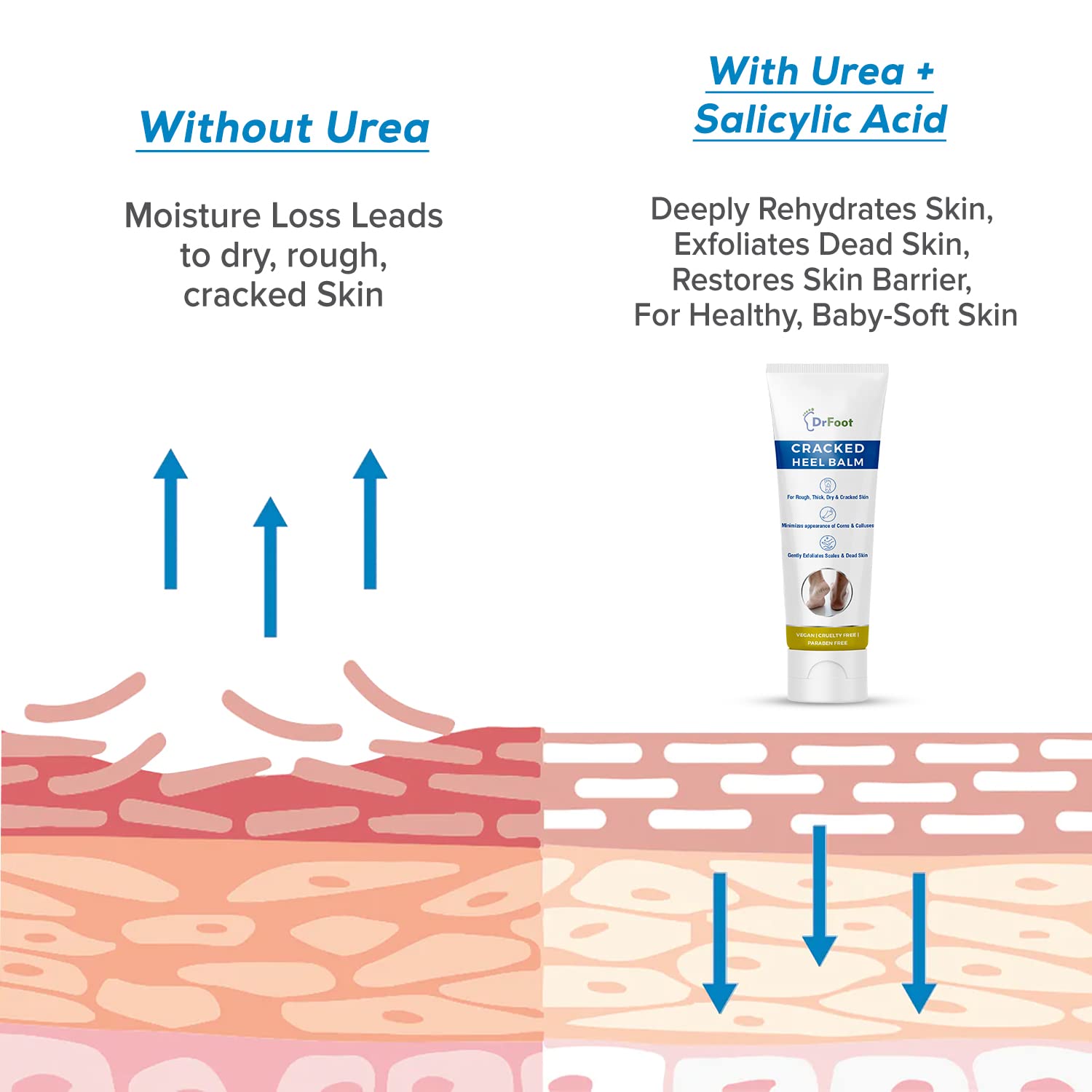 Dr Foot Cracked Heel Balm - Moisturizing dry skin