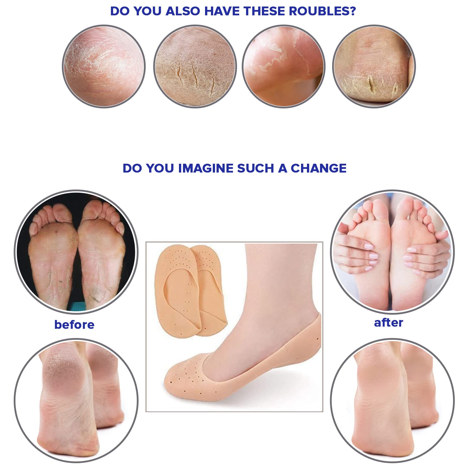 10 Pack Silicone Moisturizing Heel Socks For Cracked Dry Skin - Men Women Unisex