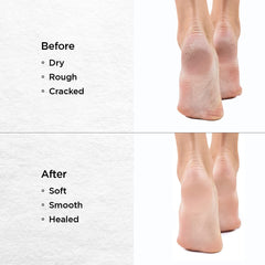 Dr Foot Callus Remover Gel Helps to Remove Calluses and Corns - 100ml & Dr Foot Glass File Callus Remover | For Feet, Dead Skin, Callus Remover - ROSE GOLD
