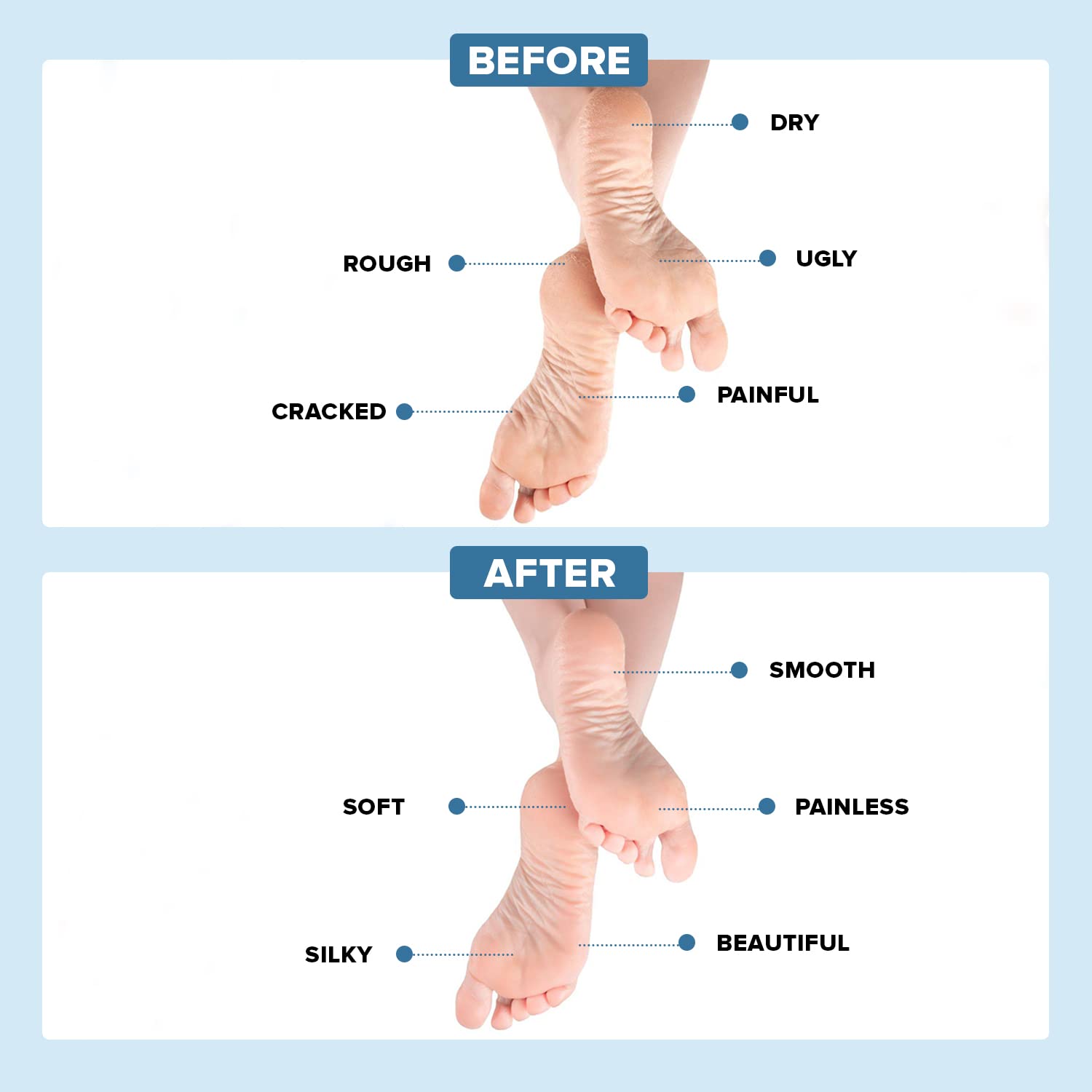 5 tips to heal cracked heels | HealthShots