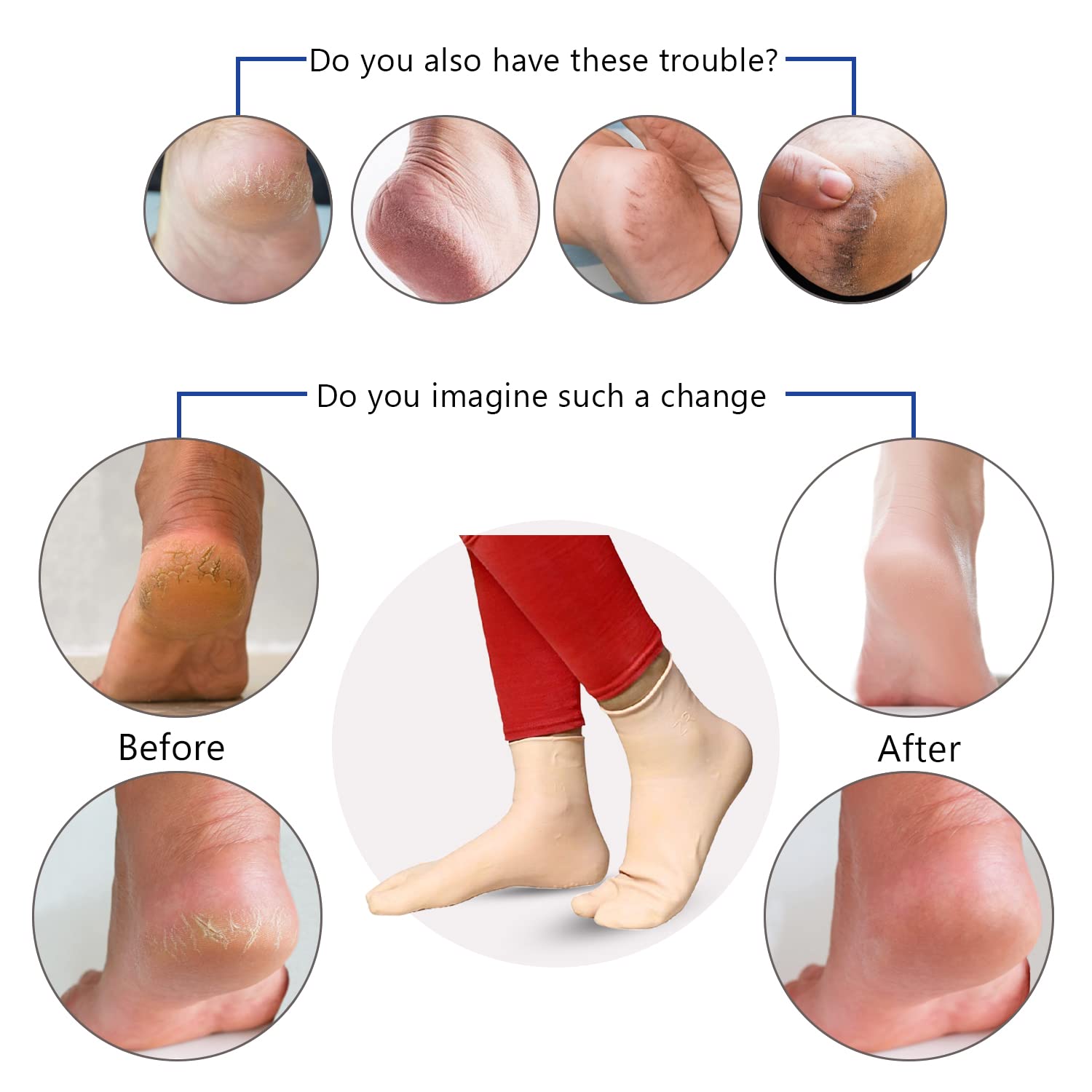 Dr Foot Silicone Socks | Anti Slip Silicone Moisturizing Socks | Dry Cracking Skin | For Both Men & Women | Full Length, Medium Size – 1 Pair