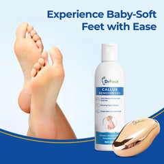 Dr Foot Callus Remover Gel Helps to Remove Calluses and Corns - 100ml & Dr Foot Glass File Callus Remover | For Feet, Dead Skin, Callus Remover - ROSE GOLD