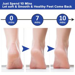 Dr Foot Foot File Callus Remover | For Dead skin, Calluses, Cracked Heels & Hard Skin Remover | For Wet & Dry Feet | Reusable/Waterproof | Unisex | With Free Brush (Pack of 10)