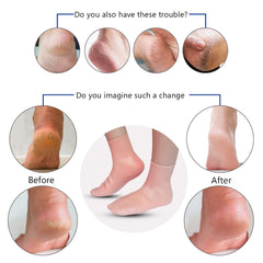 Dr Foot Silicone Socks | Anti Slip Silicone Moisturizing Socks | Dry Cracking Skin | For Both Men & Women | Full Length, Large Size – 1 Pair