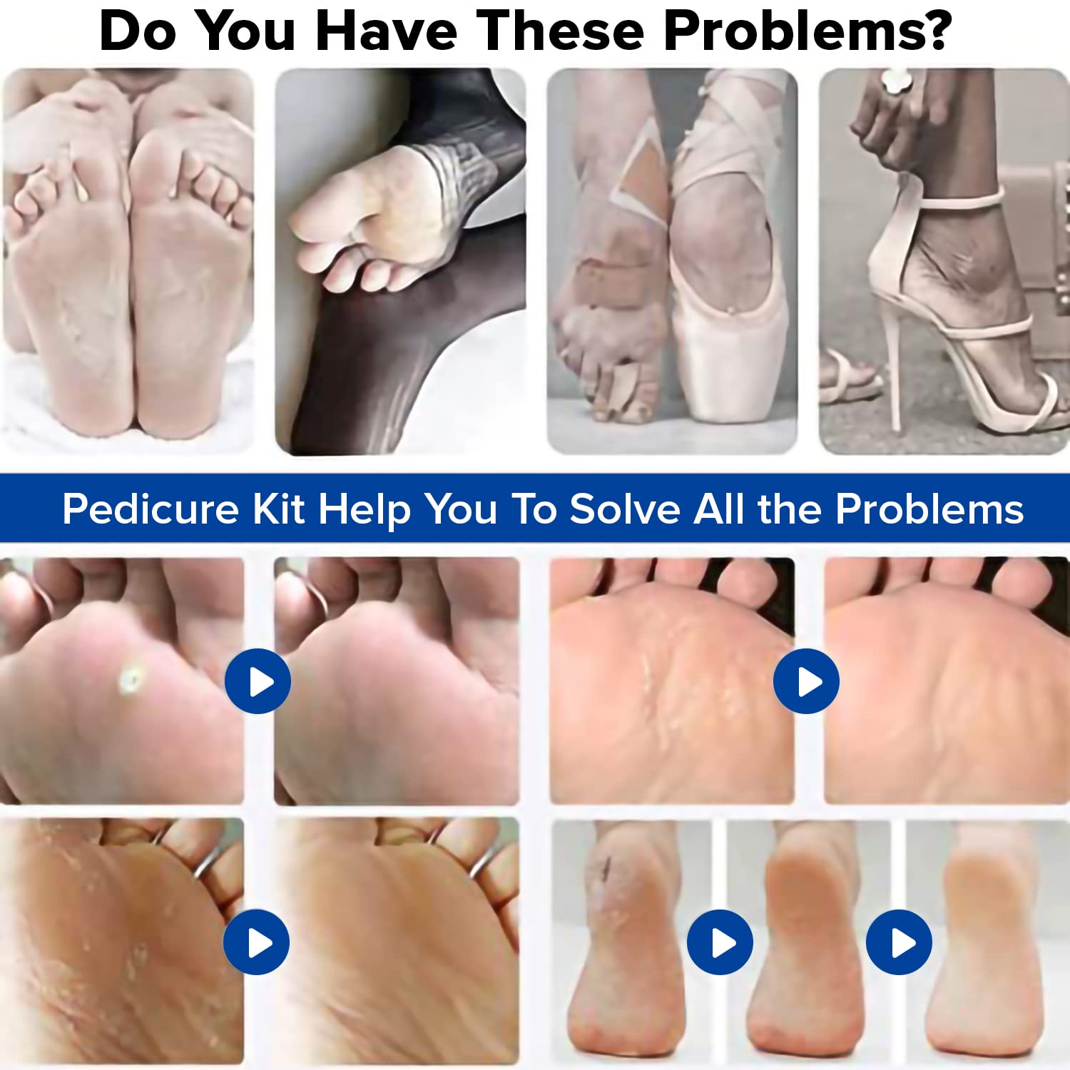 Dr Foot Pedicure Tools for Feet - 8 in 1 Pedicure Kit | Foot Scrubber for Dead Skin, Callus Remover, Foot Scraper, Foot File, Pitchfork, Filer for Nail Repair - 1 Set