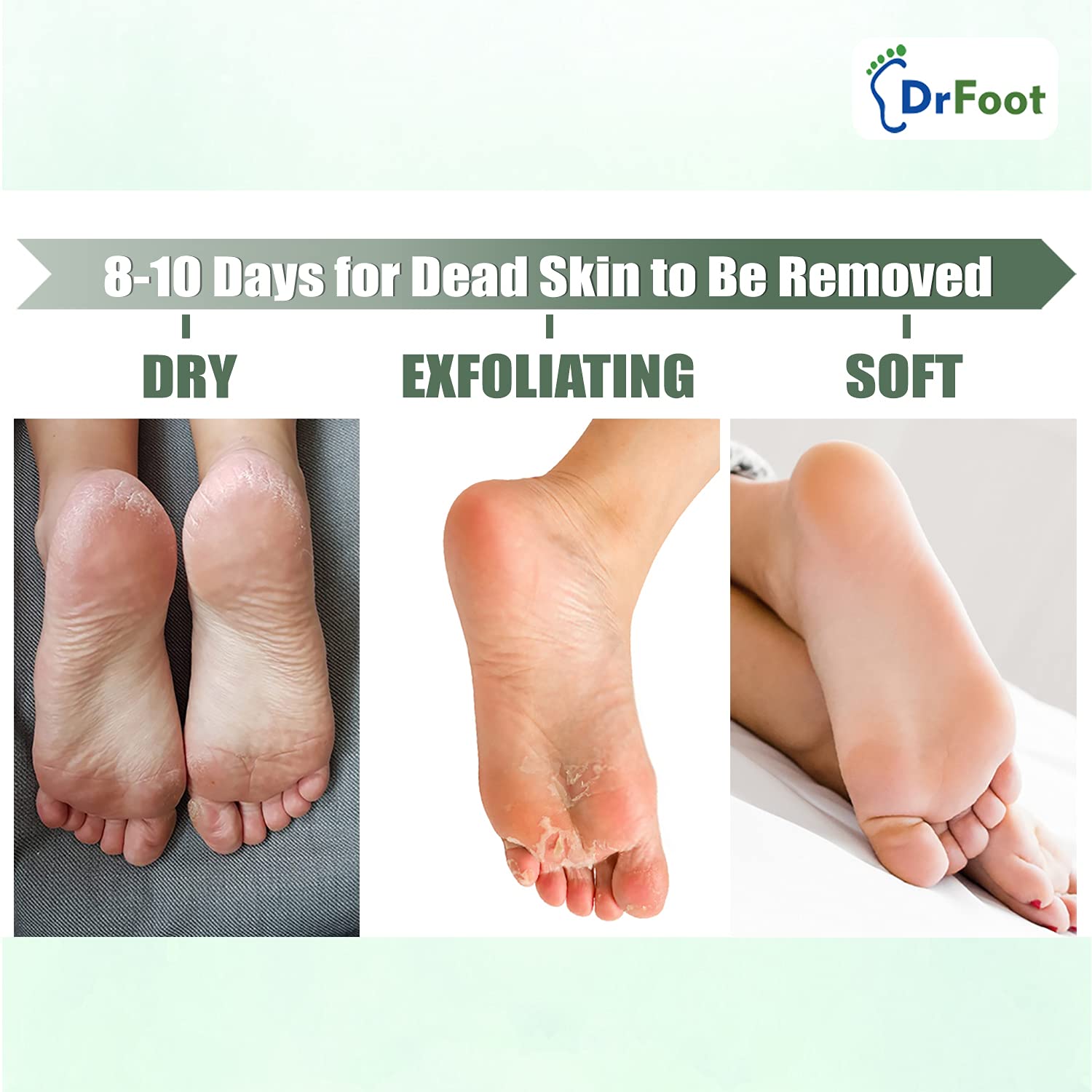 Dr Foot Exfoliating Foot Mask Sock with Urea, Lactic & Glycolic Acid and Aloe Vera - 1 Pair (Pack of 5)