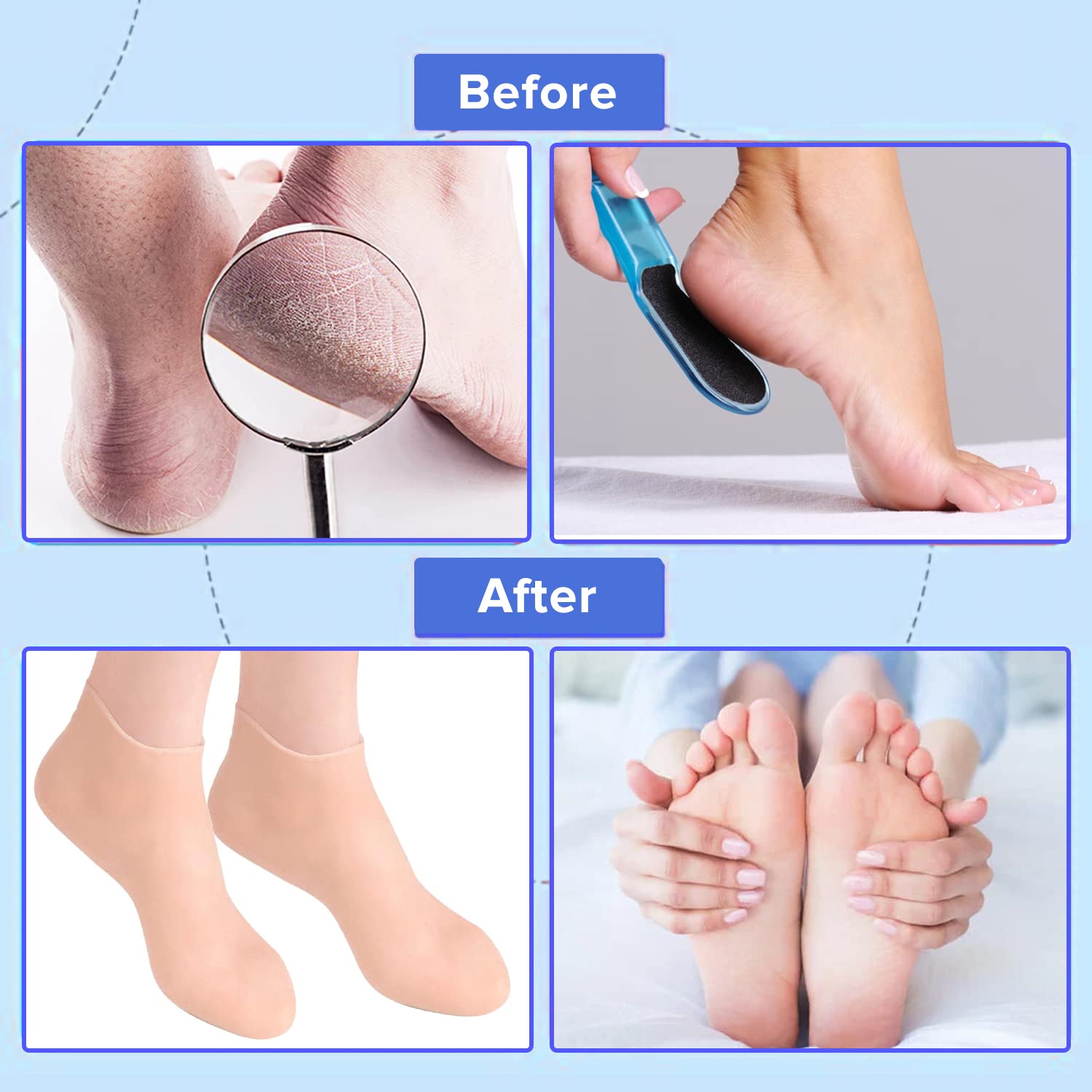 Dr Foot Silicone Socks | Anti Slip Silicone Moisturizing Socks | Dry Cracking Skin | For Both Men & Women | Full Length, Medium Size – 1 Pair (Pack of 5)