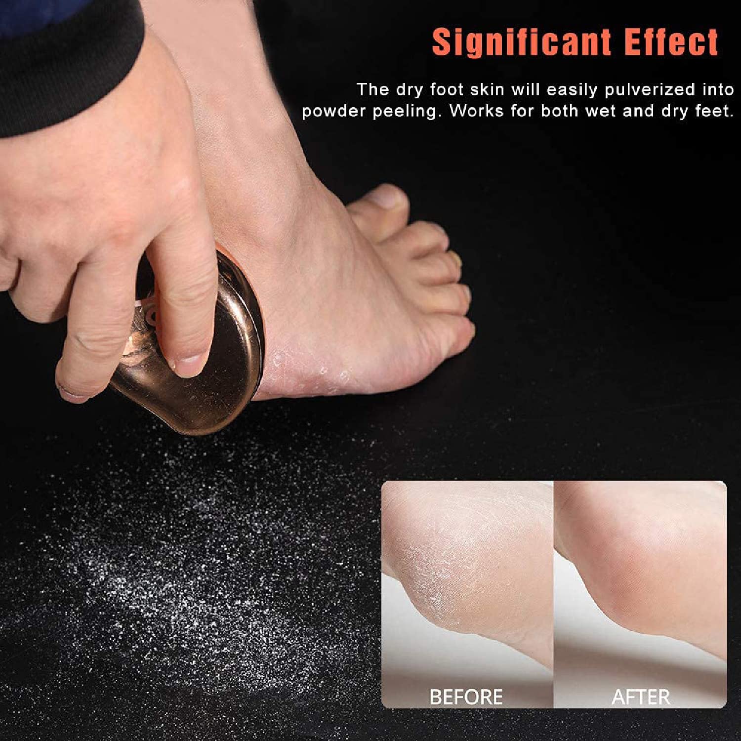 VANWIN Glass Foot File, Callus Remover for Feet Foot Scrubber Dead Skin  Remover with Nano Micro-Abrasive Particles, Foot Rasp Heel Scraper Hard  Skin