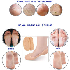 Dr Foot Silicone Moisturizing Heel Socks | For Dry, Cracked Heels, Rough Skin, Dead Skin, Calluses Remover | For Both Men & Women | Full Length, Large Size – 1 Pair (Pack of 2)