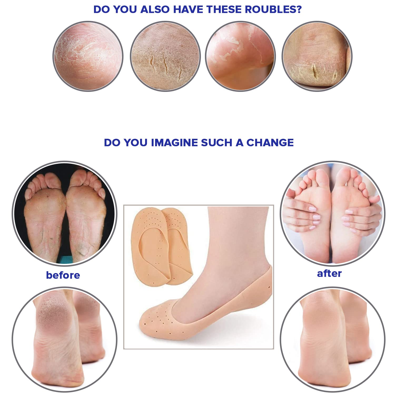 Buy eAmaze® Anti Crack Silicon Gel Heel and Foot Protector Moisturizing  Socks - Heel Socks Pain Relief Heel Cracks Foot Care Protector for Men &  Women (Beige, Free Size) Online at Lowest