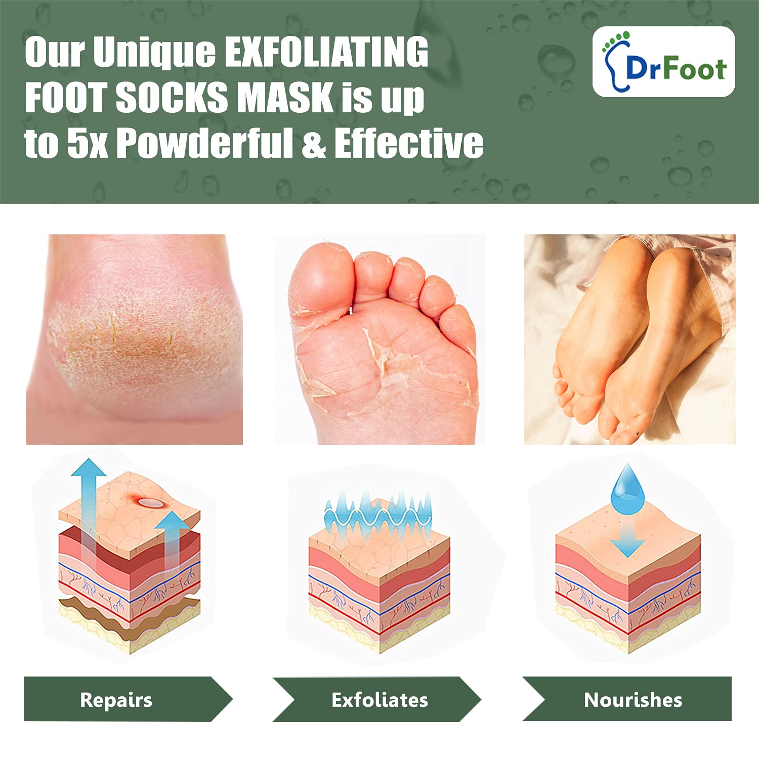 Dr Foot Exfoliating Foot Mask Sock with Urea, Lactic & Glycolic Acid and Aloe Vera - 1 Pair (Pack of 5)